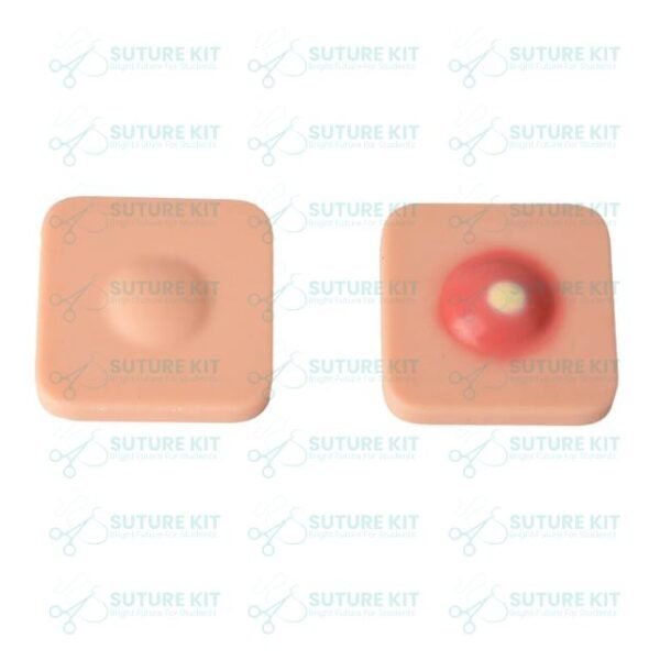 Abscess Incision & Drainage Pad